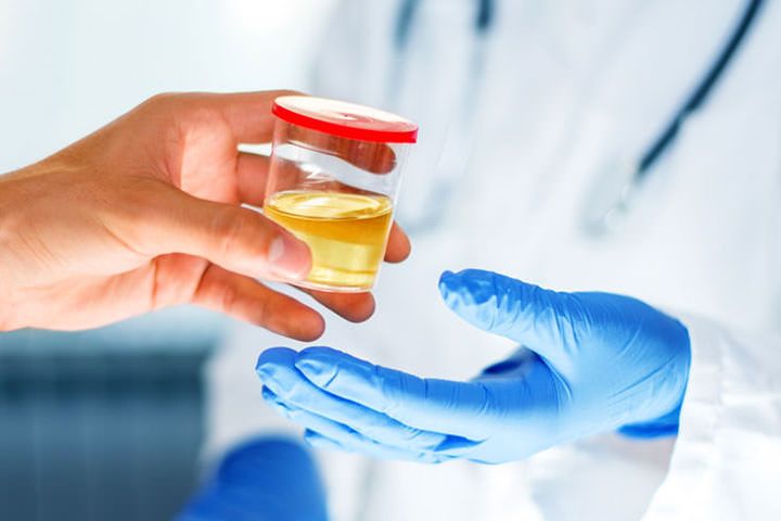 Granta Medical Practices Urine test